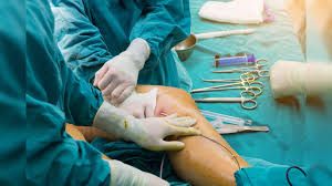 Clinictor - Which Clinics Should I Choose for Limb Lengthening Surgery?