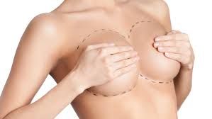 Clinictor - Affordable Breast Augmentation Mexico