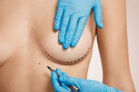 Clinictor - Affordable Breast Augmentation Turkey