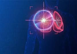 Clinictor - Customized Cancer Treatment Approaches for Better Outcomes in Brazil