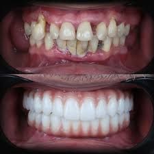 blog-image