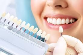 Clinictor - Achieve Your Perfect Smile with Dental Veneers in India A Comprehensive Guide