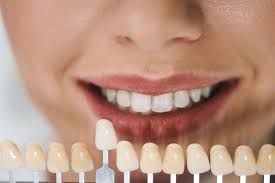 Clinictor - Transform Your Smile and Confidence with Dental Veneers in Ireland