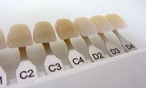 Clinictor - Transform Your Smile with Dental Veneers Across Mexico A Complete Guide