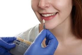 Clinictor - Transform Your Smile with Dental Veneers in Brazil A Comprehensive Guide