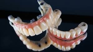 Clinictor - Why Israel is a Top Destination for Full-Mouth Dental Reconstruction