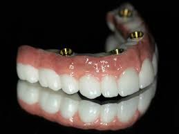 Clinictor - Why Malaysia is the Perfect Destination for Full-Mouth Dental Reconstruction?