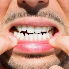 Clinictor - Why the United Arab Emirates is a Premier Destination for Full-Mouth Dental Reconstruction?