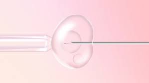 Clinictor - IVF Treatment in Israel, A Comprehensive Guide to Parenthood