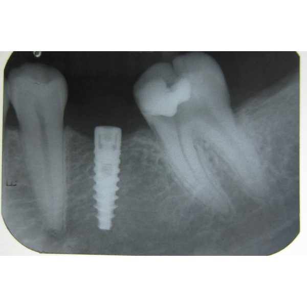 32 smiles. your gum care and beyond...!!! - Clinictor