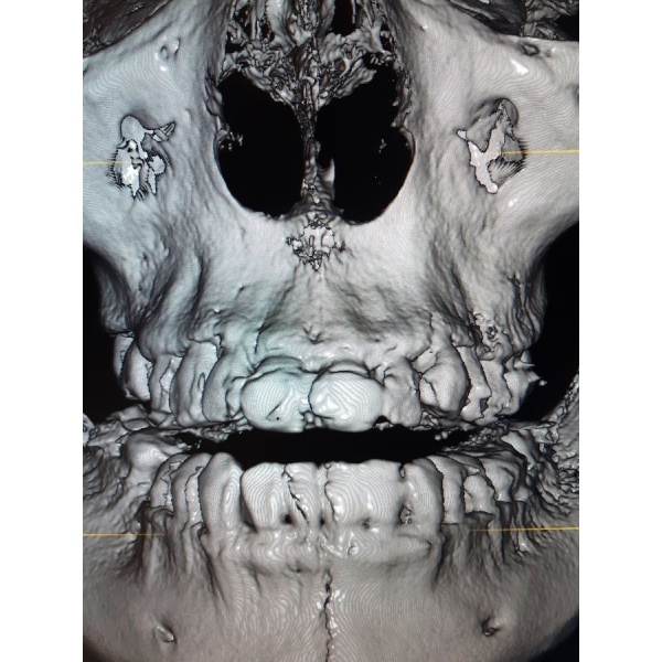 3D X-Ray in Nuevo Progreso - Clinictor