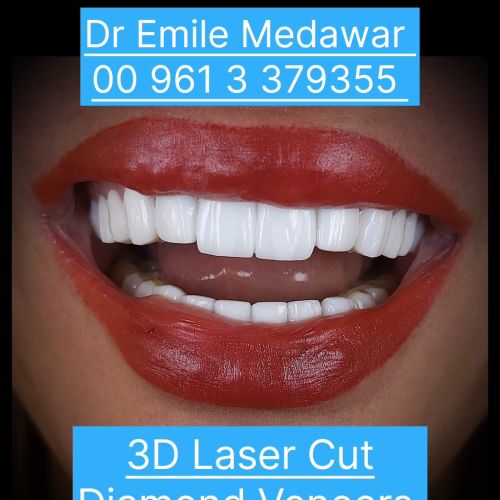 Dentist lebanon Dr Emile Medawar - Clinictor