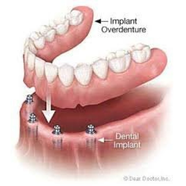Aashvi Dental Care - Clinictor