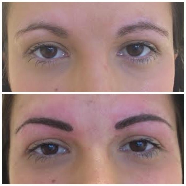Abby Stacey - Advanced Skin Treatments - On Tyne - Clinictor