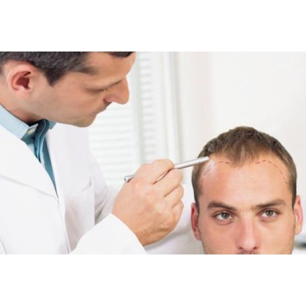 Advanced Hair clinics Tirana - Clinictor