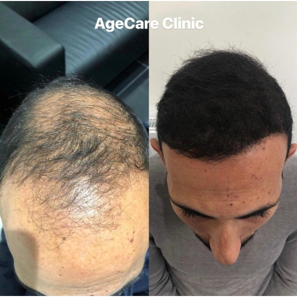 Age Care Clinic - Clinictor