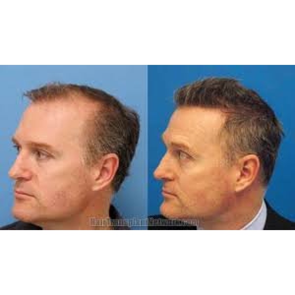 Ardem Free Consultancy Hair Clinic - Clinictor