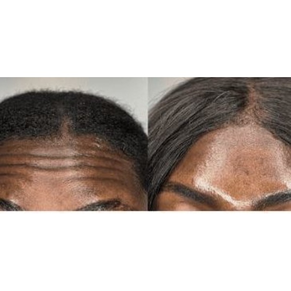 Areje Aesthetics - Clinictor