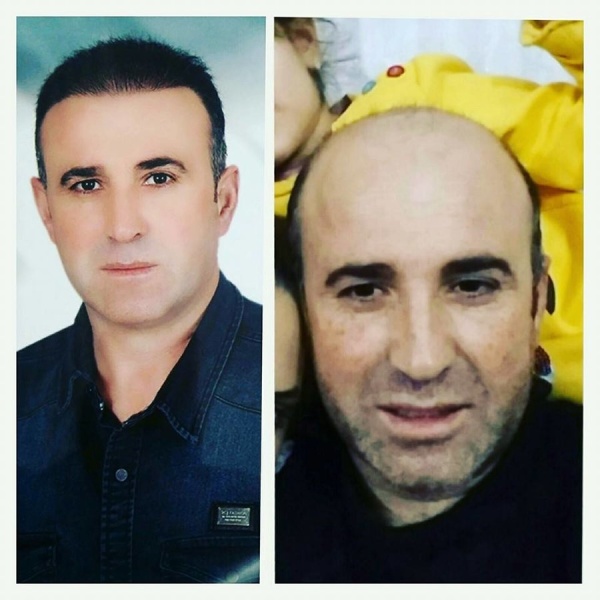 Aslı Tarcan Hair Clinic - Clinictor