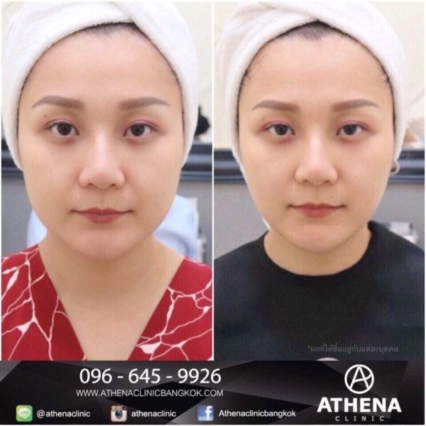 Athena Clinic - Clinictor
