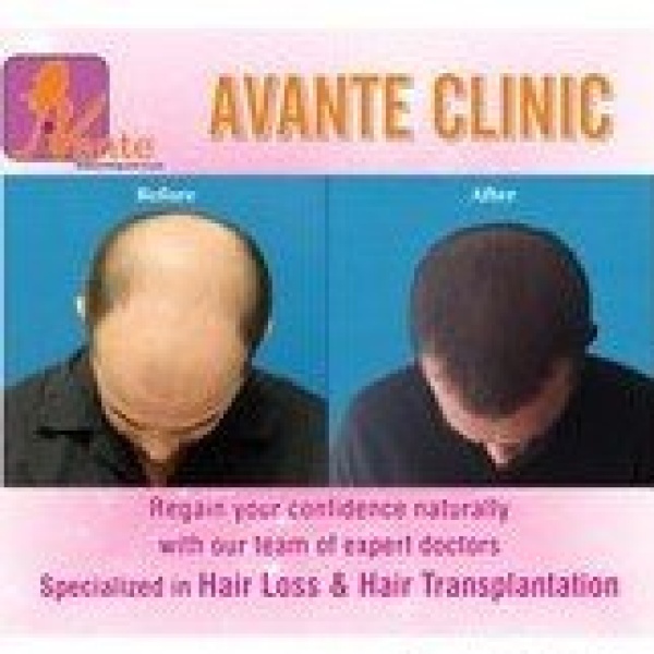 Avante - Clinictor