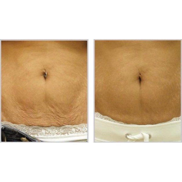 Better Body Surgery - Manchester - Clinictor