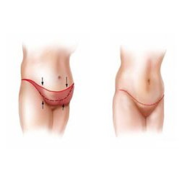 Cairo Slim Clinic - Clinictor