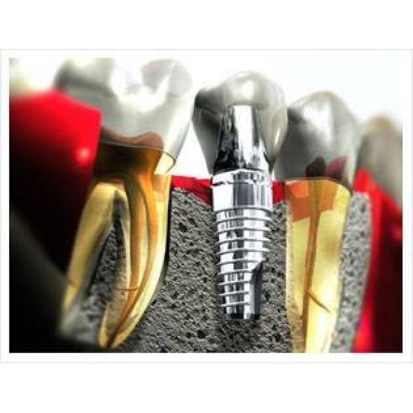 Dental Frames - Clinictor