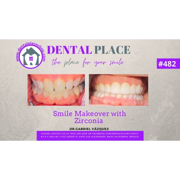 DENTAL PLACE - Clinictor