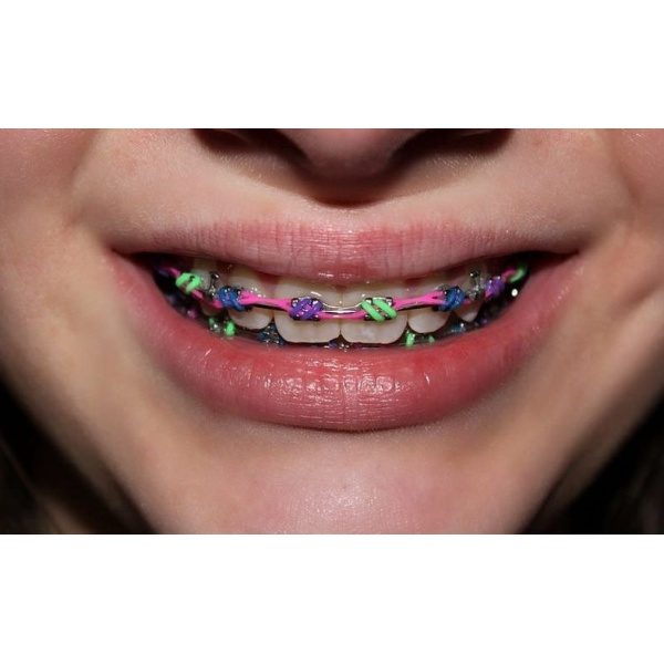 Dental Tree Jalandhar (Dental Implants & Invisible Braces Specialty Centre) - Clinictor