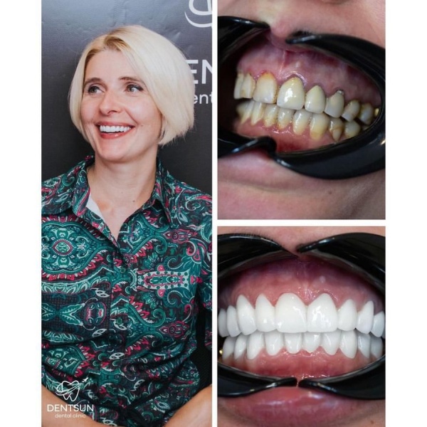 DENTSUN DENTAL CENTER - Clinictor