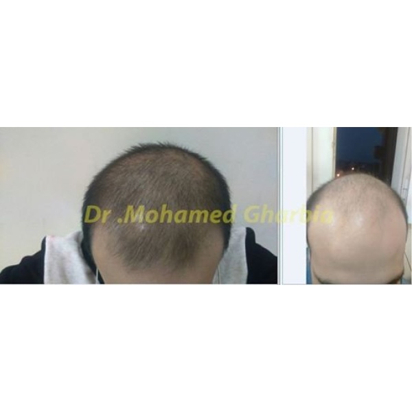 Derma & hair transplantation clinic - Clinictor