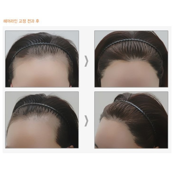 Dr.Ahn Hair Transplant Clinic - Clinictor