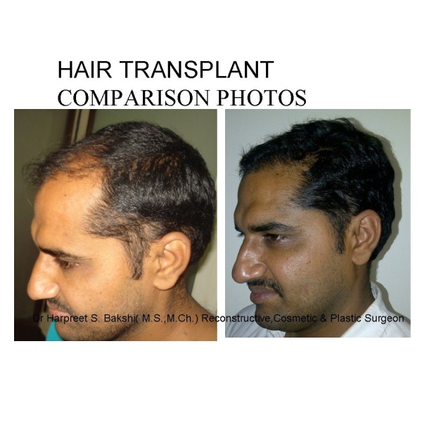 Dr Bakshi Cosmetic Clinic - Clinictor