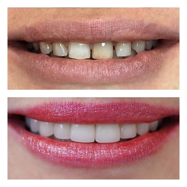 Dr Dt Akvan KİBAR - Clinictor