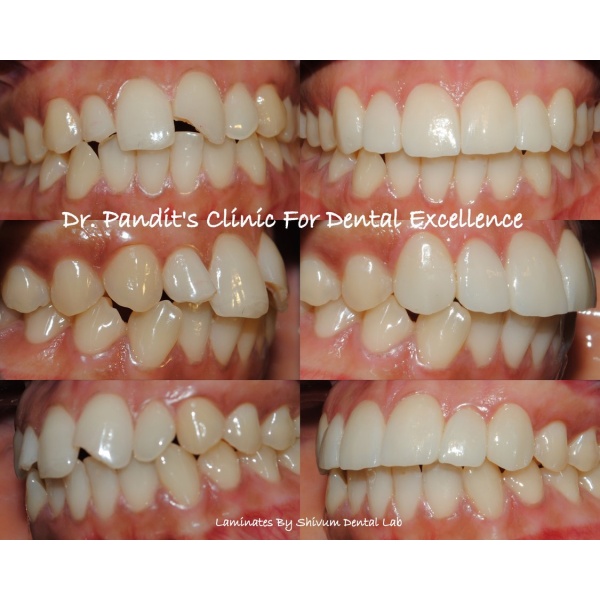 DR. PANDIT'S CLINIC FOR DENTAL EXCELLENCE & IMPLANT CENTRE PASHAN PUNE - Clinictor