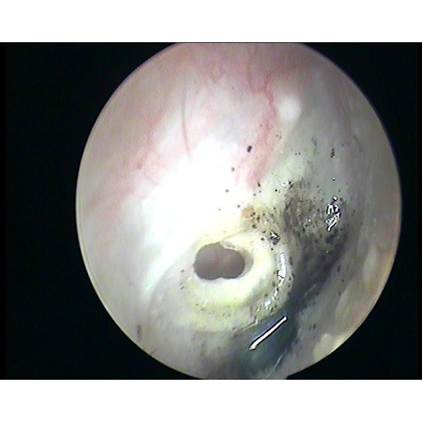 ENT, Head, Neck clinic and hearing aid centre - Clinictor