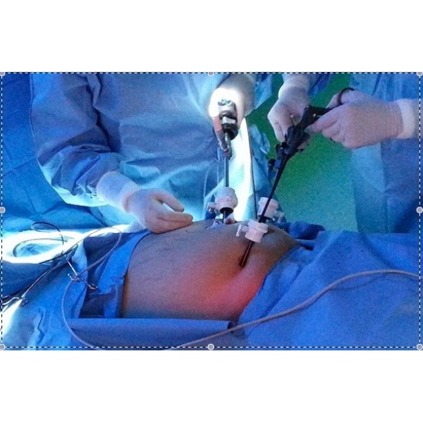 Clinictor - General and Laparoscopic Surgery Clinic