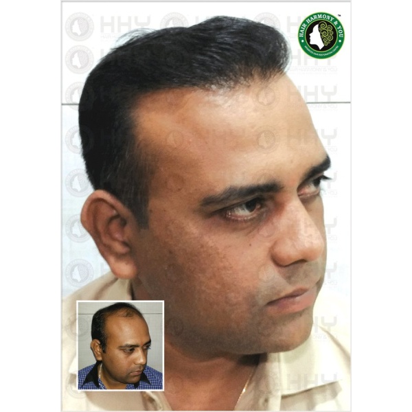 Hair Harmony and You - Mumbai - Clinictor
