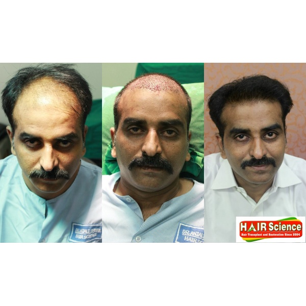 Hair Science kolhapur - Clinictor