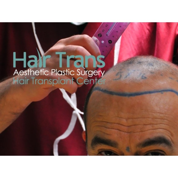 Hair Trans - Clinictor