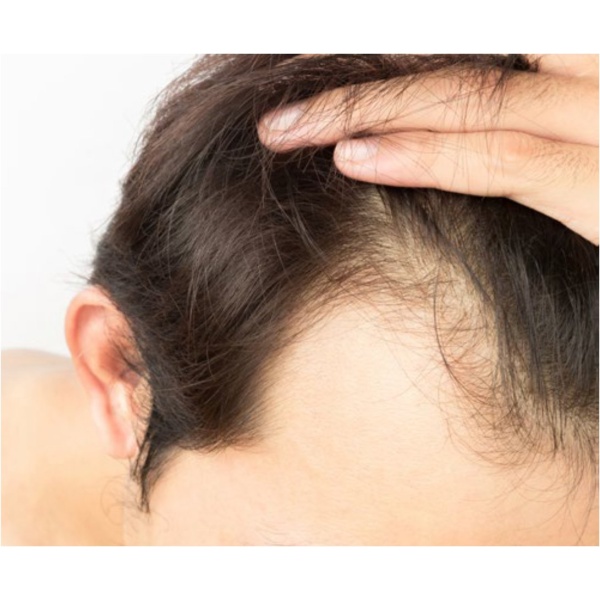 i-Hairmed - Clinictor