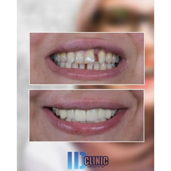 International Dental Clinic - Clinictor