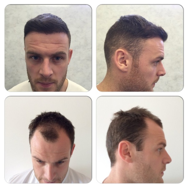 KSL HAIR CLINIC MAIDSTONE - Clinictor