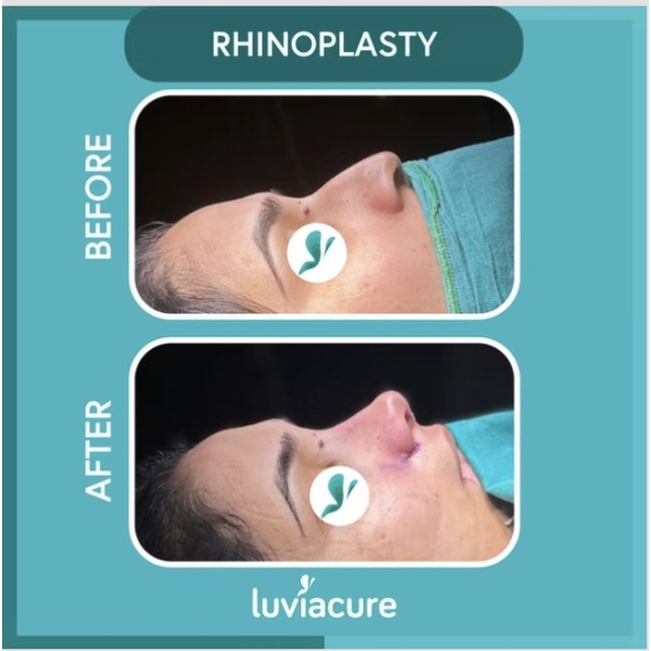 Luviacure London - Clinictor