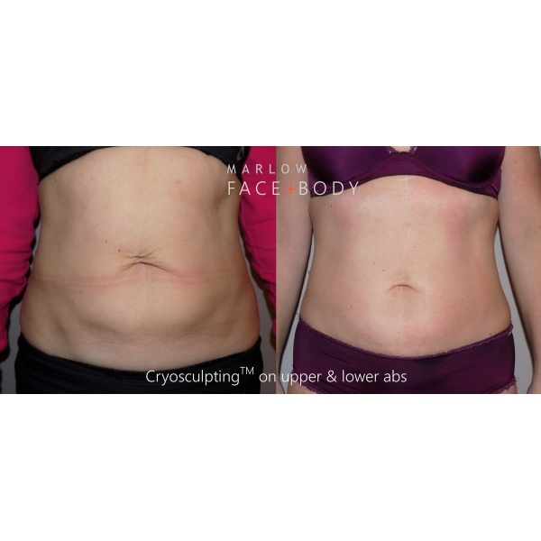 Marlow Face & Body - Clinictor