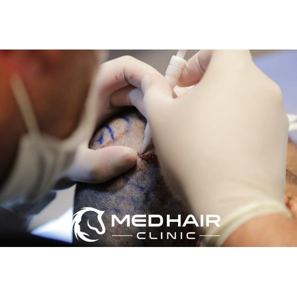 Medhair Clinic Hair Transplant - Clinictor