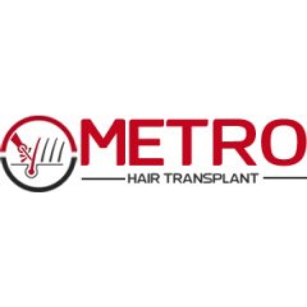 metro Hair Transplant clinic- Ambala - Clinictor