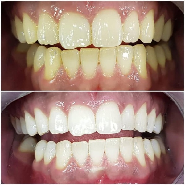 Minedentin Dental Clinic - Clinictor