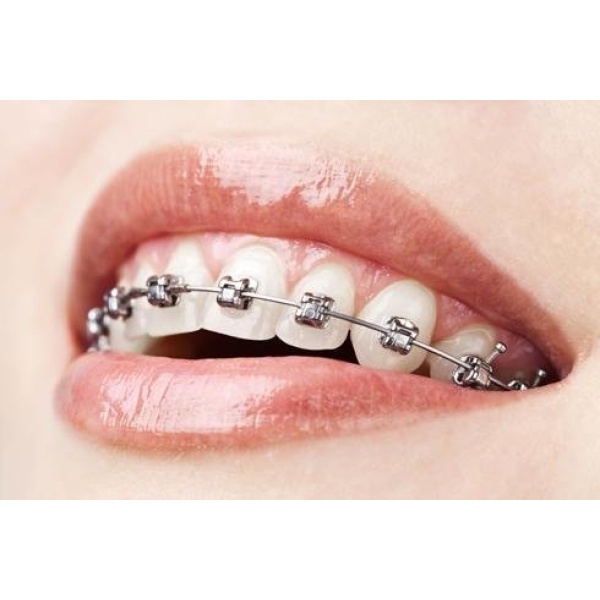 ODL Dental Clinic - Clinictor